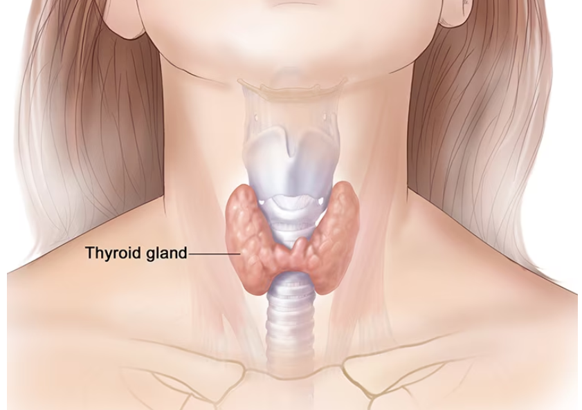 What is hypothyroidism? What is Natural Desiccated Thyroid Extract?