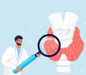 How did you develop and cause hypothyroidism?